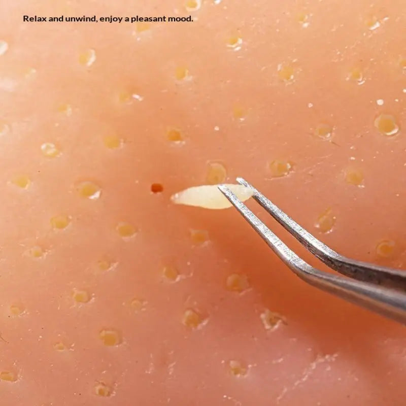 Satisfying Pimple Popper Game - Reusable Silicone Toy for Stress & - product image 3